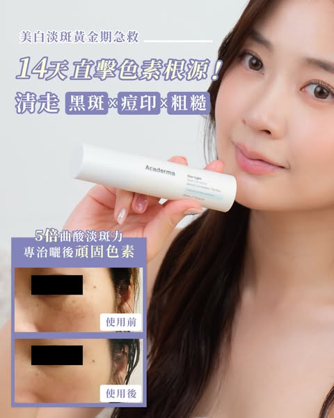 dr koala — 50% off Acaderma whitening serum for post-summer skin brightening and spot fading.