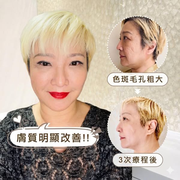 Ingrid Millet: New customers get two professional facial treatments for HKD 580 plus free gift…