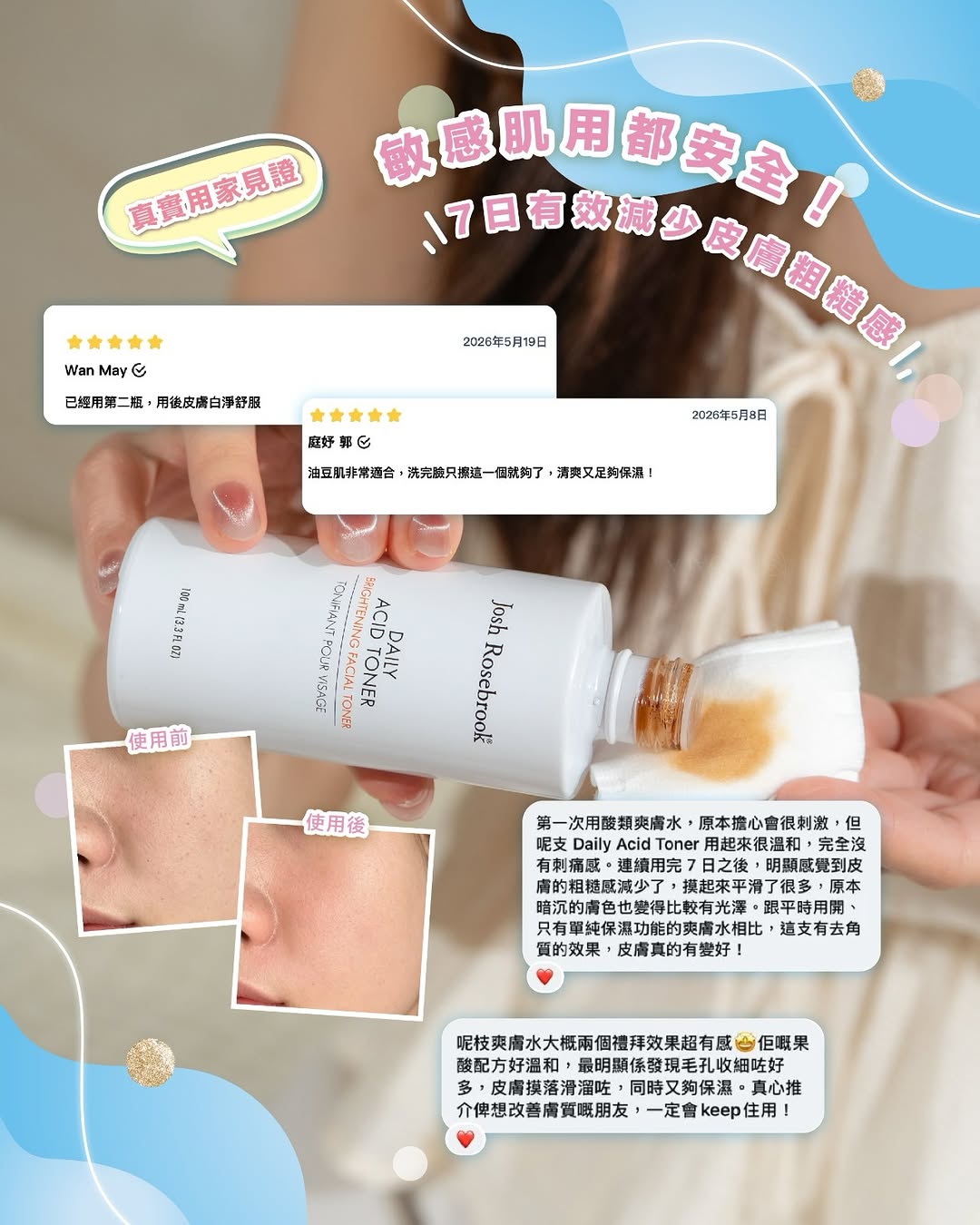 dr koala — Josh Rosebbrook toner reduced from HK$330 to HK$209. Limited to 100 units, 17-23 June only.